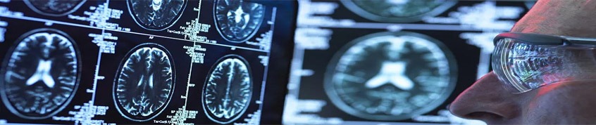 神經(jīng)干細(xì)胞移植的過程