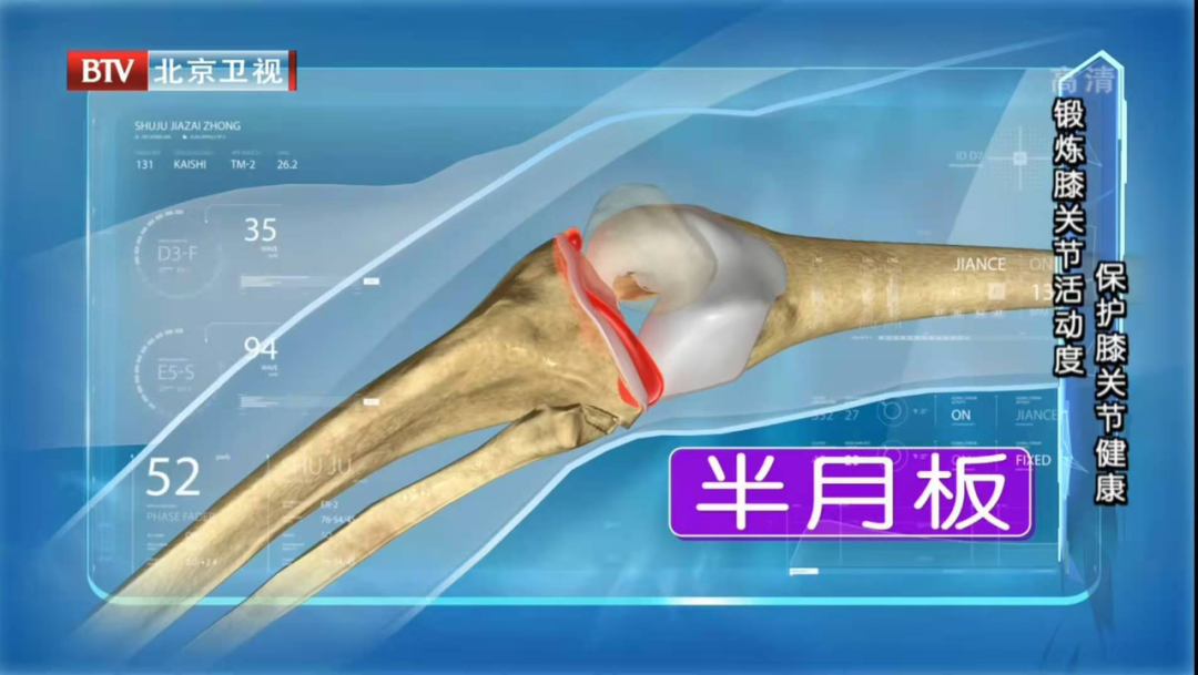 干細胞治療半月板損傷臨床試驗患者招募！