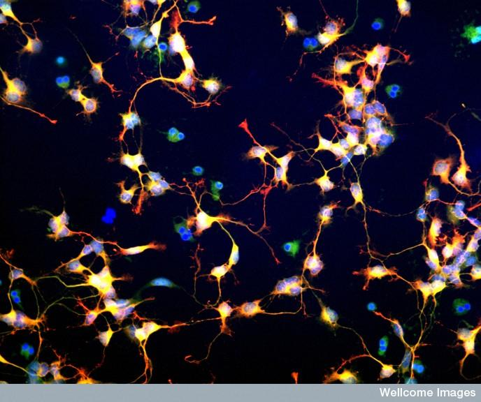 中科神經干細胞