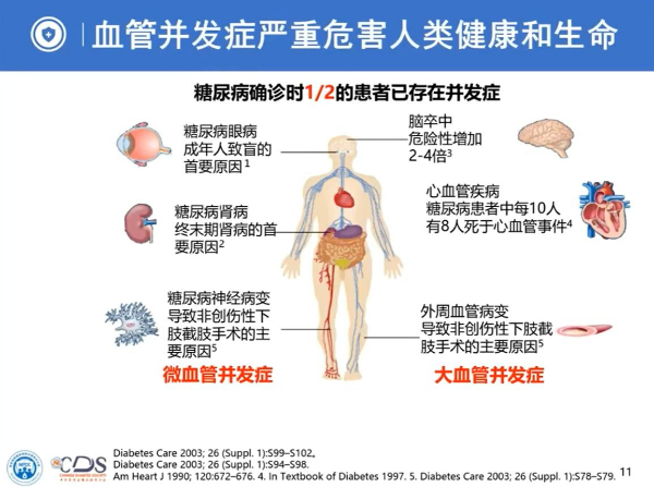 間充質干細胞治療糖尿病并發癥