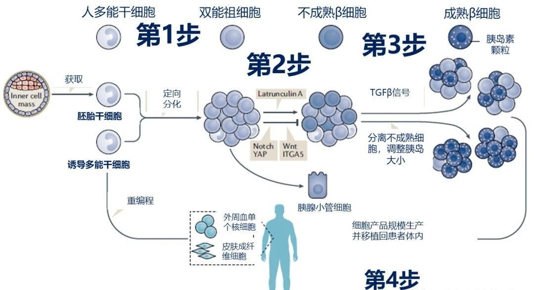 干細胞治療糖尿病的原理和機制