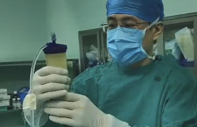 青島市中心醫院：創新脂肪干細胞療法，為60歲患者解除十年關節炎困擾