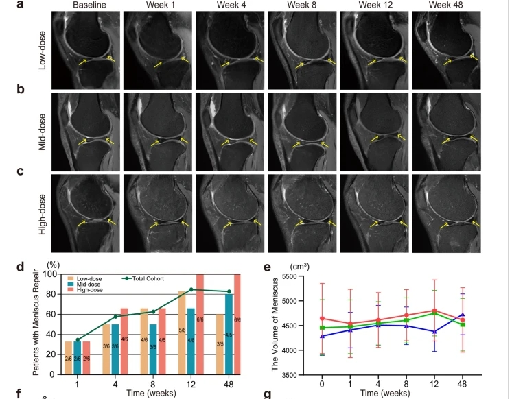 a – c不同劑量組膝關節(jié) MRI 掃描中的半月板損傷。d半月板修復患者百分比。e注射后六個時間點的半月板體積分析。