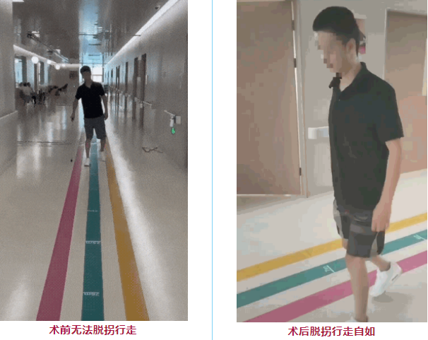 干細胞治療脊髓損傷臨床項目