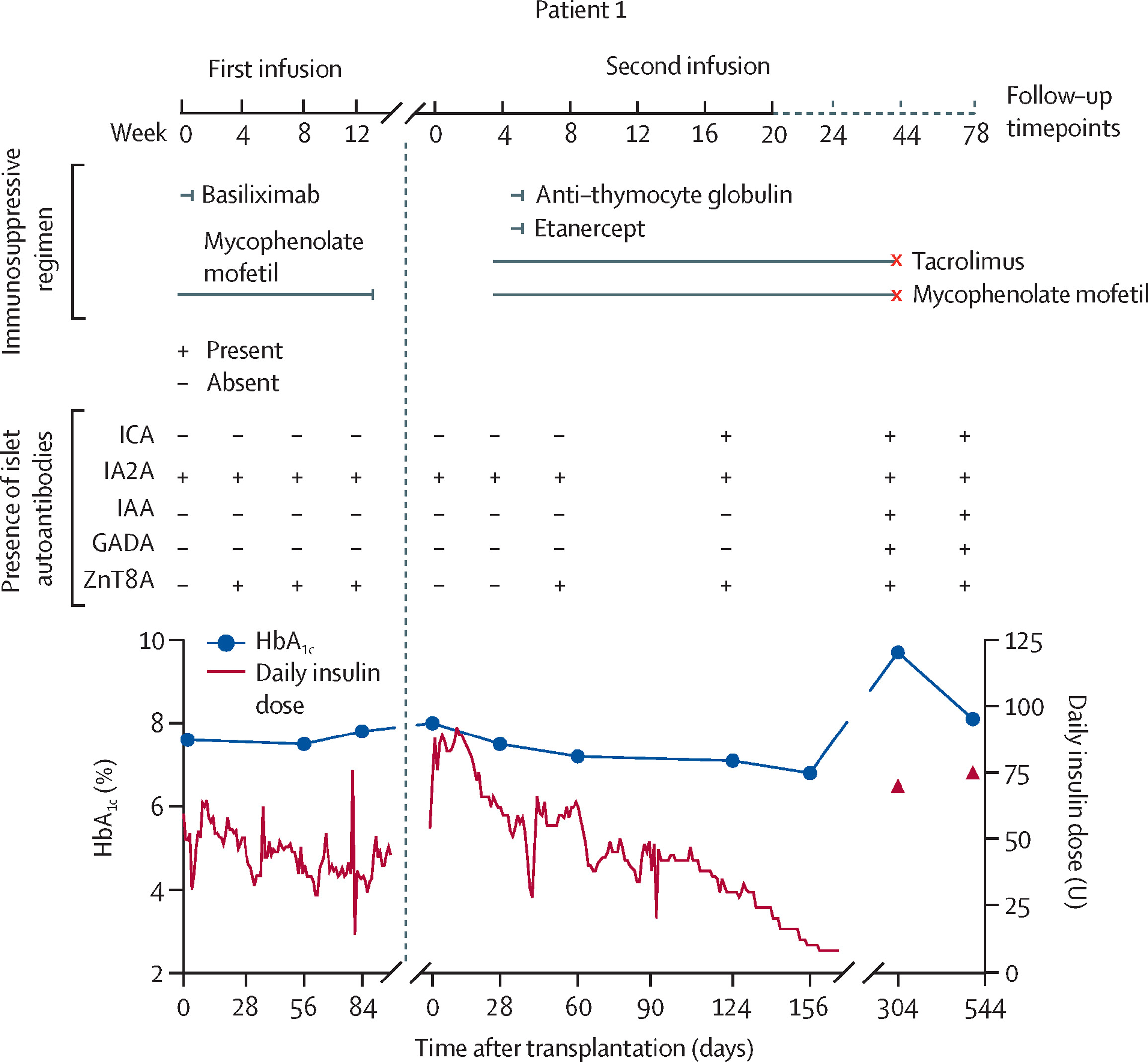 圖1：自體和異體E-胰島移植聯合不同免疫抑制方案治療患者1的療效